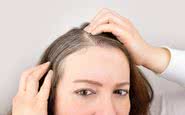 É quando os cabelos estão sob a pele, como folículos, que eles estão sujeitos à influência de hormônios do estresse - iStock