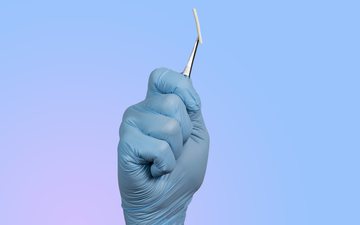 O implante está para vencer e ela está insegura quanto à eficácia do contraceptivo - iStock