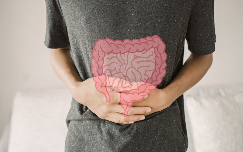 A síndrome do intestino irritável pode afetar muito a qualidade de vida - iStock