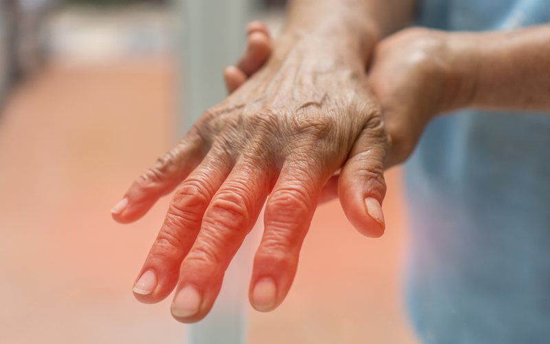 Formigamento ou dor nas mãos ou nos pés podem indicar danos aos nervos causados pelo diabetes - iStock