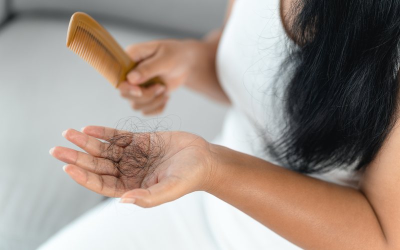 Todos os dias, perdemos cerca de 100 fios de cabelo - iStock