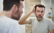 Essa queda inicial é chamada de shedding e costuma se iniciar 2 semanas após início do medicamento - iStock