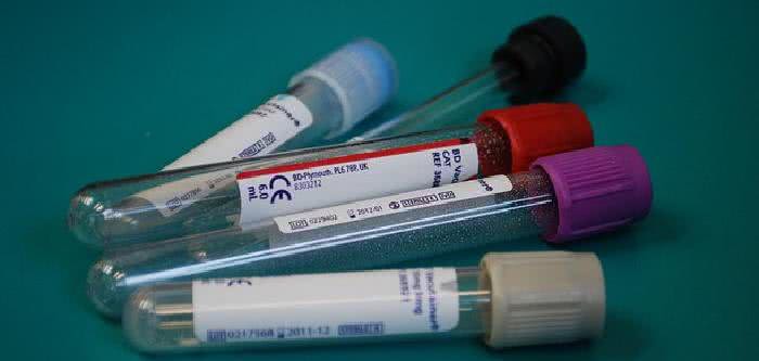 Imagem Exame de sangue poderá ajudar médicos a diagnosticar a psicose em estágios iniciais